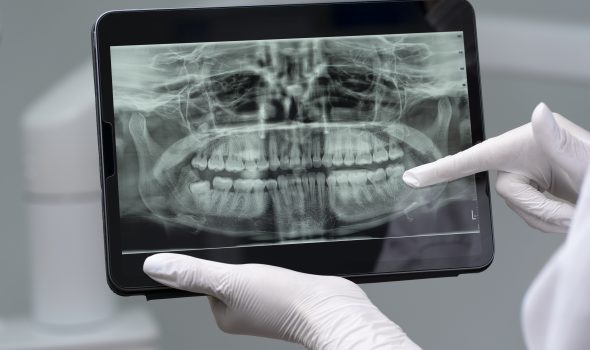 close-up-dentist-instruments